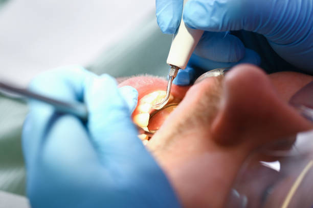 Best Emergency Treatment for Toothache in Apple Creek, OH
