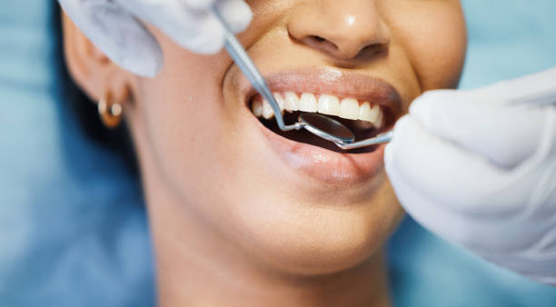 Best Walk-In Emergency Dentist in Apple Creek, OH